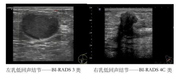 医生边做B超边我好爽，竟然发现了意想不到的健康秘密，让人惊叹不已！