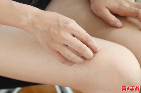 淑娟两腿间又痒了：探讨皮肤瘙痒的原因及其对生活质量的影响与应对策略
