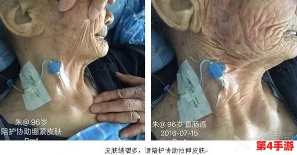 红肿疼痛小缝不能合拢，可能是感染、缝合不当或组织愈合问题，需及时就医